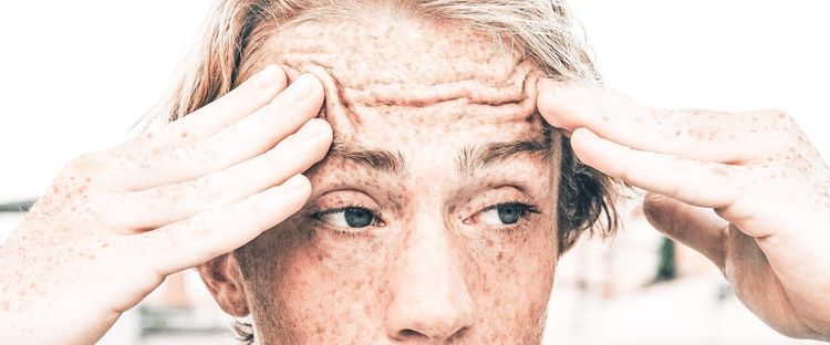 Freckled face with deep forehead wrinkles, hands pressing temples.